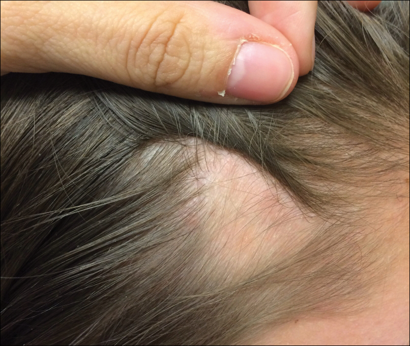 Comprehensive Clinical Guidance to Address Hair Loss in Women